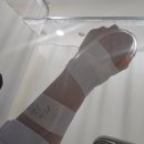 서울여성병원 | 자궁폴립절제술 용종제거 당일 입퇴원 보험 청구 후기 (서울여성병원부천)
