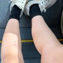 라인메드 | 압구정 종아리보톡스 관리 2회차 솔직후기 (바쿠메드 / 지방분해주사)