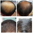 비앤비메디칼 이미지