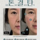 나의미래피부과의원 | 여의도나의미래피부과에서 톤결탄으로 피부고민 끝!