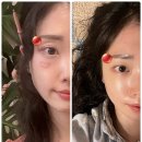 눈가주름 부기 탄력관리 홈케어 디바이스 + 화이트태닝 세럼