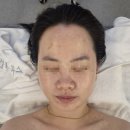 세븐일레븐가정루원시티점 | 루원시티 피부관리 추천! 뷰티하리 루원시티점 ESV10 모공디톡스 후기