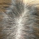 둔산의료기 | 대전 둔산동 smp studio 2회차 관리 후기❗ 엑소좀 두피재생, 달라진 점 공개