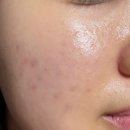 사하구 하신번영로 | 사하구마사지 찾는다면? 예민 피부도 편했던 이정은 스킨앤바디 후기