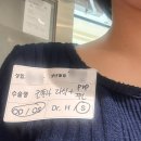 강남의원 | 강남그랜드안과의원 컨투라라식 후기 (스마일라식 비교)