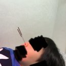 유아 비염 치료 4차