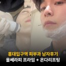 신화역사공원입구1 2 | 홍대입구역 피부과에서 울쎄라피프라임 온다리프팅 3만줄 남자가 받고온 후기