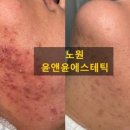 노원역 5번출구 이미지