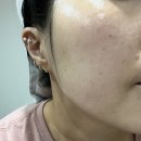 베리어스컴 | 광고 아니고 진짜 내돈내산 후기, 디마프 풀세트로 다시 돌아온 이유