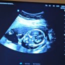 청두곶8길 16-5 | [17주차] 서초 함춘 여성의원 양수검사 후기