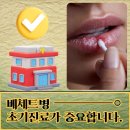 류마본내과의원 | 부산 수영 류마본내과의원과 알아보는 자가면역질환의 원인