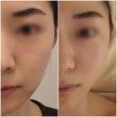 아나 피부샵