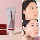 메디컬바른약국 | 피부 예민할때 속보습 부터,피부 재생크림 추천 피더린 리쥬부스터 후기