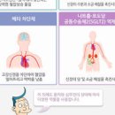 심부전 원인 진단 심부전증 이미지