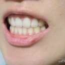 새하얀홈케어 이미지