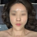 로터스 에스테틱 | [강남] 신논현 피부관리 에스테틱, 로터스에스떼_물광테라피 강력 추천 후기