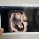 이장현산부인과의원 | [안동 산부인과] 이장현산부인과 초음파 꼼꼼하고 친절하게 봐주시는 곳 옥동