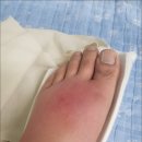 아산하나의원 네이버블로그