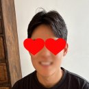 양악수술 그 시기는 언제가 좋을까요? / 더페이스치과 후기