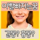 이빨빠지는꿈 특별히 조심해야 하는 이유! 이미지