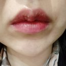 [이미지컨설팅] 마곡 틴트입술 및 통증 후기