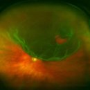 바른안과 이미지