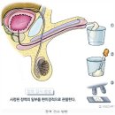 불임증상.정액검사에 대해서 알아봐요. 이미지