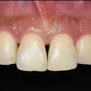 편한치과기공소 이미지