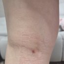 장미꽃과 나이팅게일 피부과의원 이미지