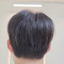 모모즈헤어&증모 이미지