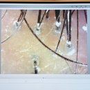 일산 두피케어 아이디헤어 주엽2호점에서 클리닉 받은 솔직후기