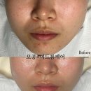 뷰에리