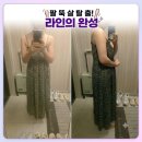 신사 지방분해주사로 매끈한 라인 만들기, 신사 제로클리닉 1회차 팔뚝시술 후기