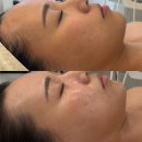 서영왁싱&에스테틱 테라피 | 창원 피부관리 '재린샵에스테틱&왁싱' 골드테라피 솔직후기