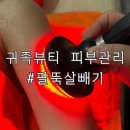 부천 상동 다이어트 관리 전문 귀족뷰티 피부관리실 팔뚝살 관리 후기
