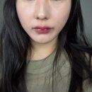 동일한의원 | 서면얼굴비대칭교정 한의원 5차 방문 후기 | 괄사 + 비강추나 + 얼굴침