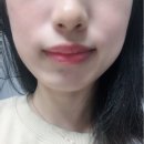 비비립 입술 LED 마스크 솔직 후기