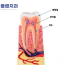 굿플랜치과의원 | 대구북구교정치과, 치간 삭제 꼭 해야 하나요? 공간 확보를 위한 안전한 교정 방법