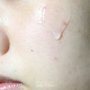 모닝리페어 이미지