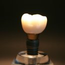 조은치과기공소 이미지