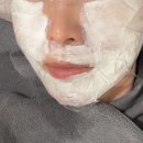 피부 요철 레이저 후기와 홈케어 A부터 Z까지 총정리