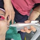 크림잠실리센츠점 | 잠실새내 리센츠 상가 피부과 토닝 레이저 효과 본 후기