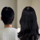 제일머리 | 서울 유잇다 항암붙임머리 후기, 5cm 길이..제일 힘드시죠?