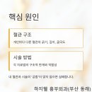 신성호 심장혈관흉부외과의원 | 레이저, 고주파, 베나실… ‘최신 시술’이 내 혈관에서 실패하는 이유