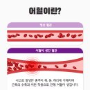 강한한의원 이미지