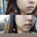 씨유범물하늘채르레브점 | 대구피부관리 수성구에스테틱 아담앤이브 범물점 재생케어 고주파관리 후기