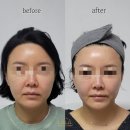 종합광고무지개 | 구래동피부관리샵, 돈 낭비 없이 찐효과 보는 무지개뷰티