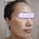 라이프반점 | (주)미셀라이프 포마 다이아 10 제품 후기