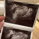 유테라산부인과의원 이미지