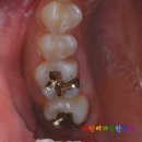 파란치과기공소 이미지